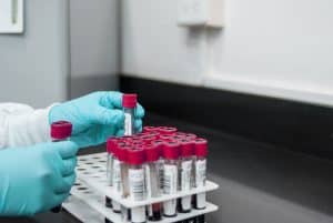 DUI Blood And Breath Tests